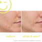 EradiKate Daily Foaming Cleanser 120ml: Radiance in Days