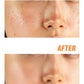 Korean C Radiance-Boosting Peeling Pads, 60 Count