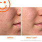 ExfoliKate Intensive 60ml - Luxe Exfoliating Skin Renewal