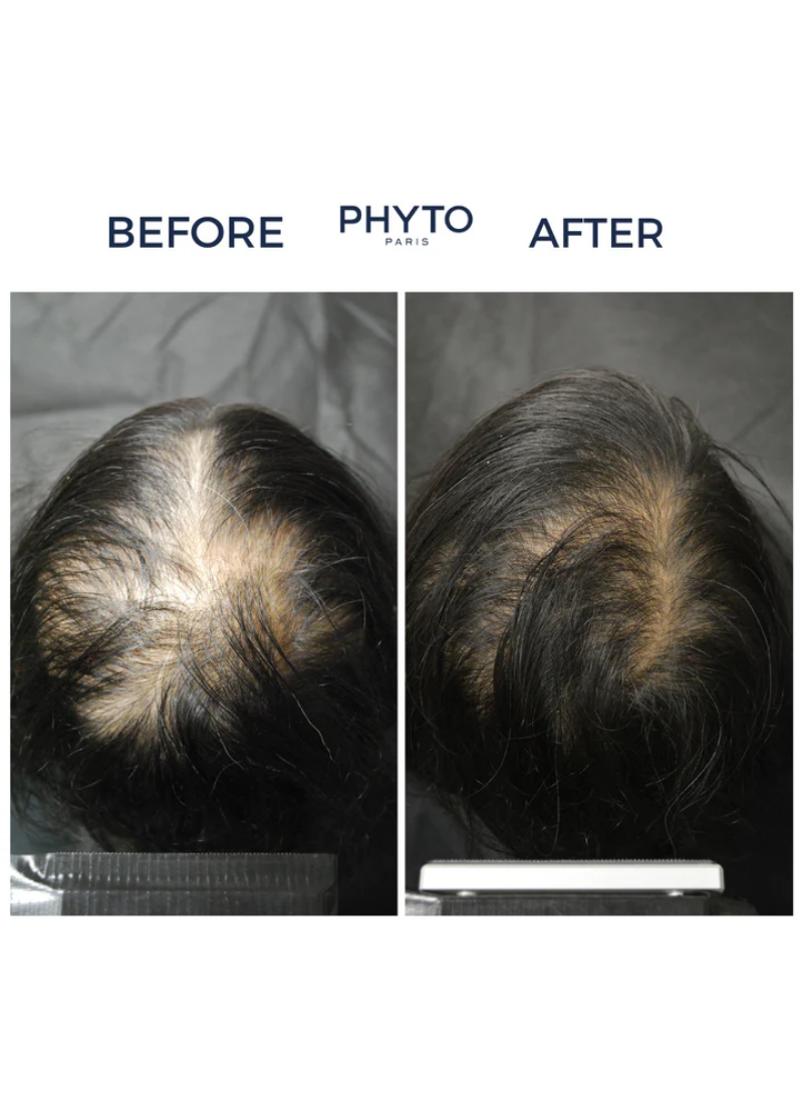 buy-phyto-phyto-cyane-densifying-hair-serum-for-women_kc3