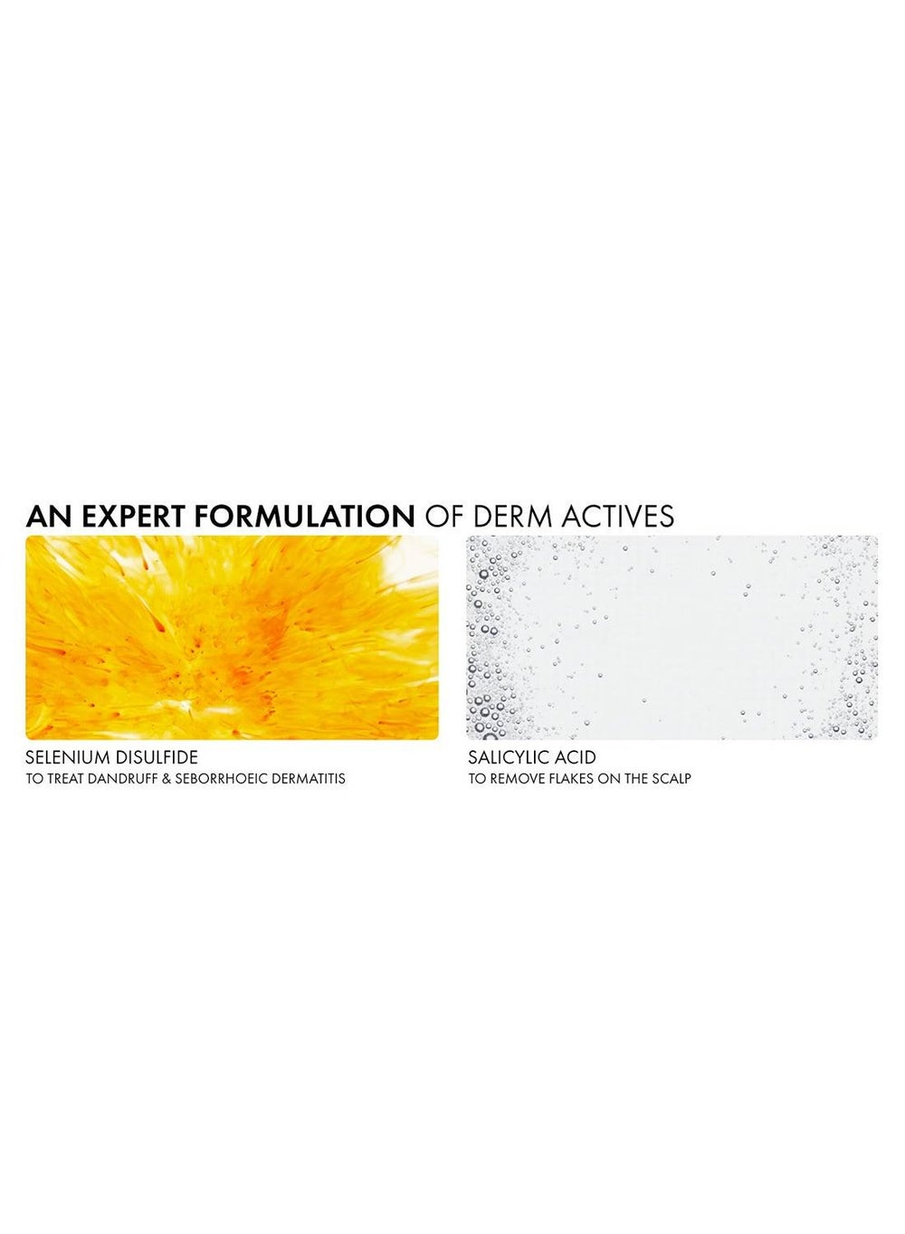 buy-vichy-dercos-anti-dandruff-shampoo-normal-to-oily-hair-refill-390ml_ueg