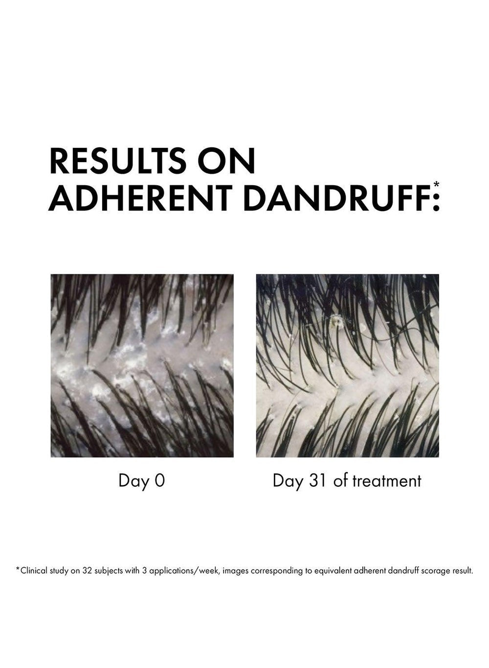 buy-vichy-dercos-anti-dandruff-shampoo-dry-refill-390ml_7k8