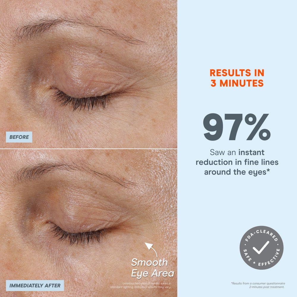 buy-nuface-nuface-r-fix-microwand_rym