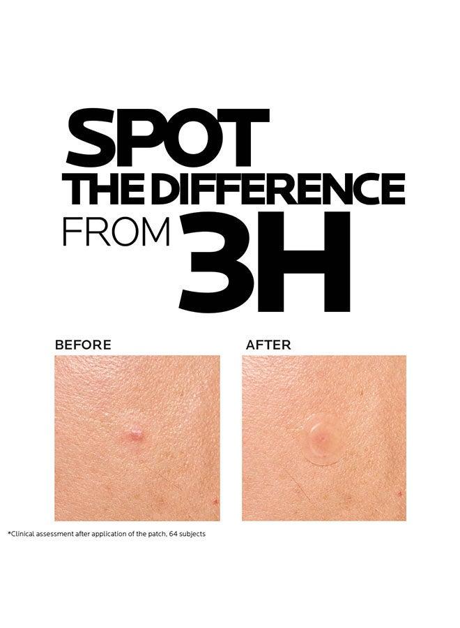 buy-la-roche-posay-effaclar-duo-m-patch-clear-pimple-plasters_v3s