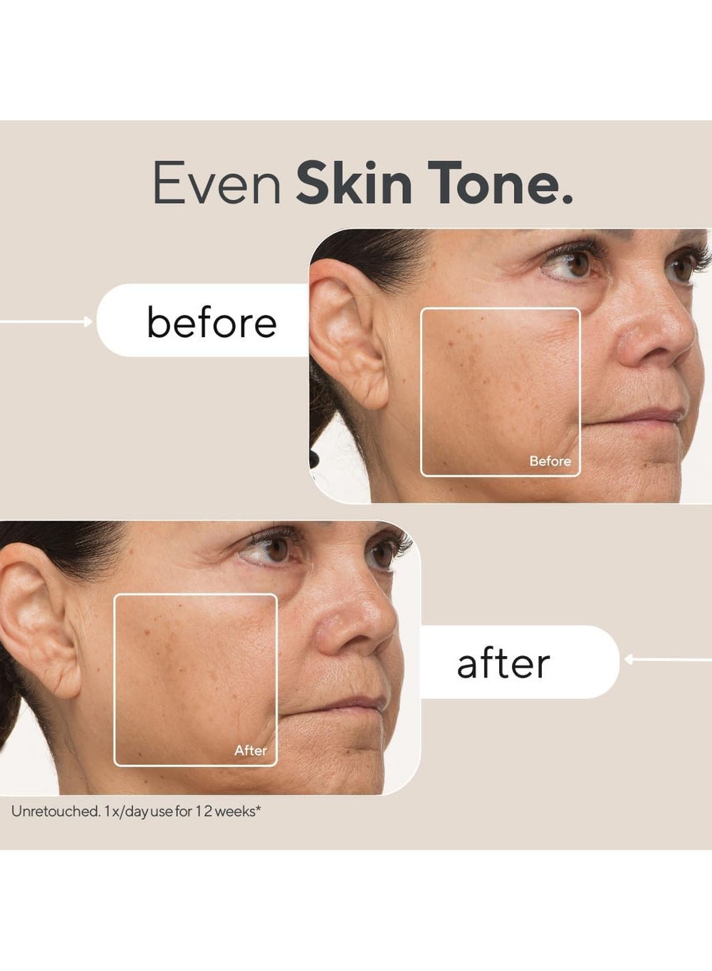 buy-therabody-theramask-by-therabody-led-light-therapy-skin-care-face-mask-with-vibrating-massage-fsa-eligible-blue-red-light-therapy-for-face-led-face-mask-facial-massager-for-wrinkles-skin-tightening-dark-spots_xwr