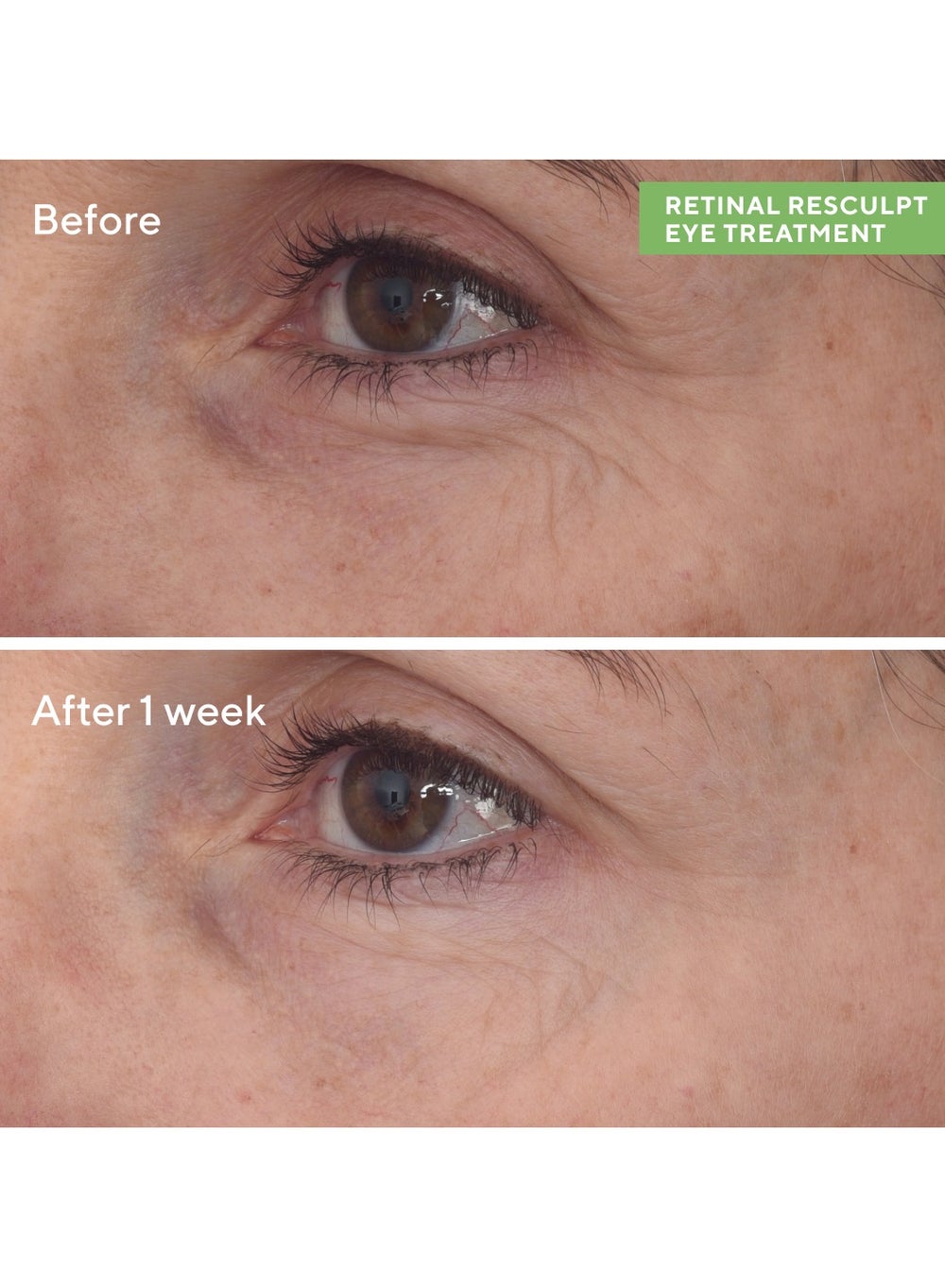 buy-murad-retinal-resculpt-eye-treatment-15ml_2cv