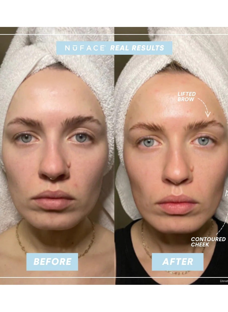 buy-nuface-nuface-trinity-classic-facial-toning-device-complete-kit_qaw