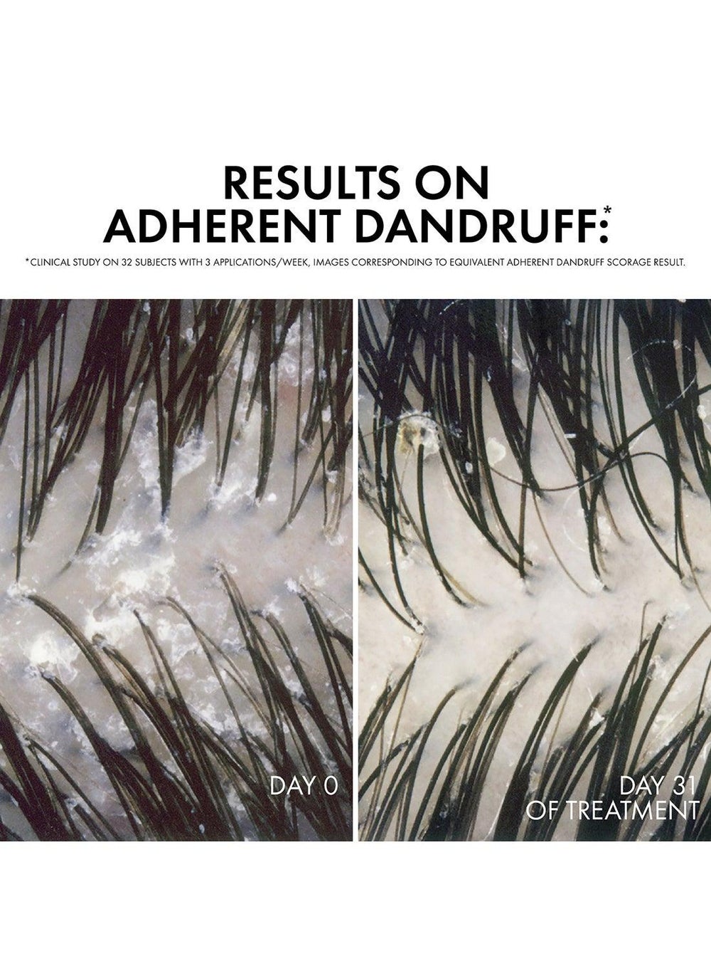 buy-vichy-dercos-anti-dandruff-shampoo-normal-to-oily-hair-refill-390ml_6rt