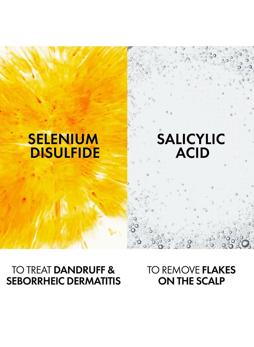 buy-vichy-dercos-anti-dandruff-shampoo-dry-refill-390ml_46n