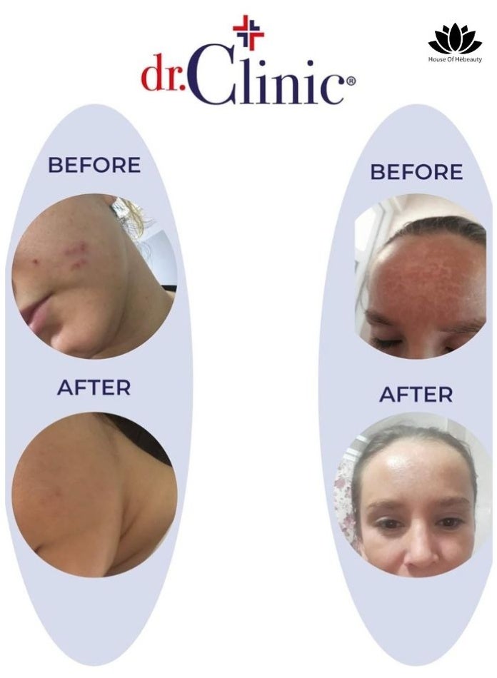 buy-dr-clinic-deep-corrective-whitening-cream_ho9