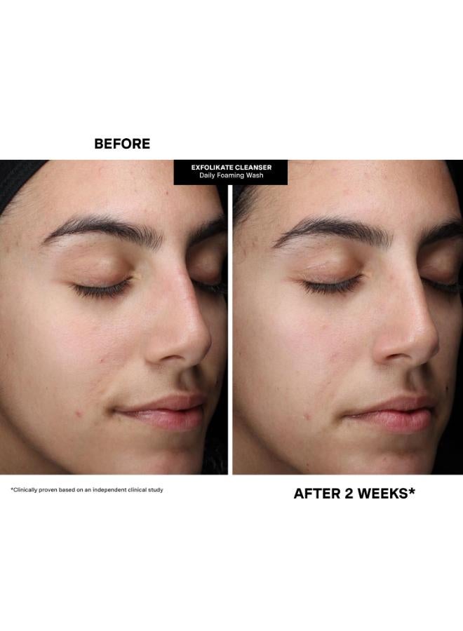 buy-kate-somerville-kate-somerville-pore-fect-holiday-trio-2025-holiday-kit-uk-aus_ezv