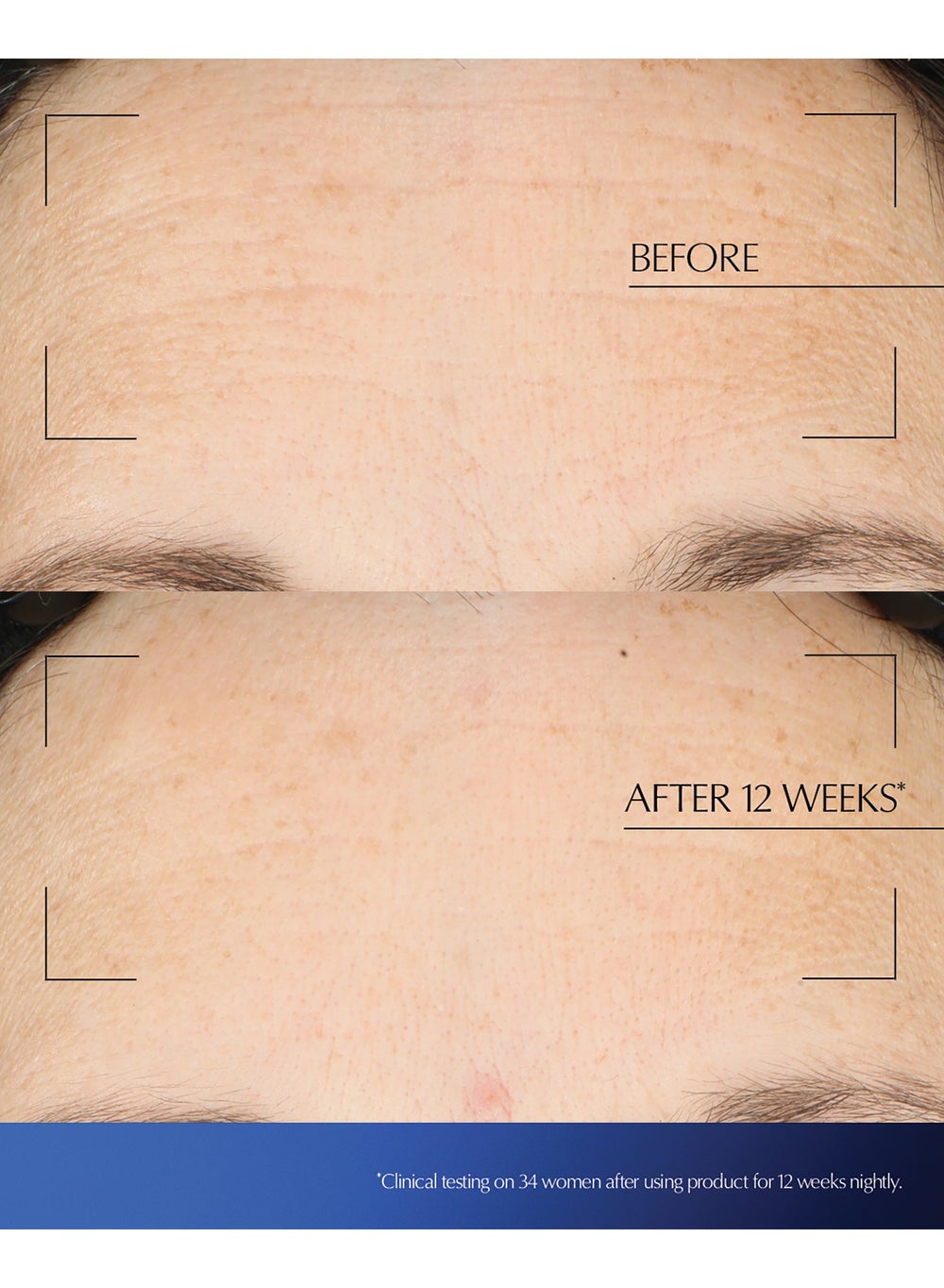 buy-estee-lauder-advanced-night-repair-overnight-treatment-65ml_6te