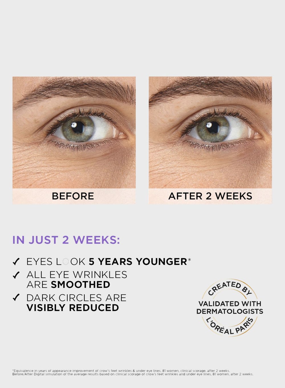 buy-l-oreal-hyaluron-eye-serum-20ml_ozh