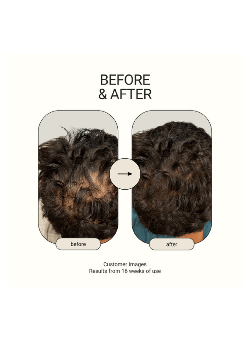 buy-rthvi-revitalize-natural-hair-growth-oil-60-ml-strengthening-nourishing-formula-for-healthy-strong-hair_hjb