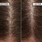 Soothing Scalp Elixir 250Ml - Combat Flakiness & Itchiness